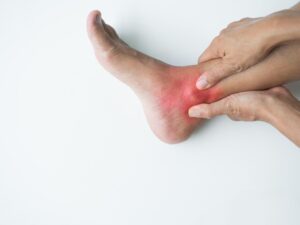 Cómo prevenir lesiones en los pies en Castellón